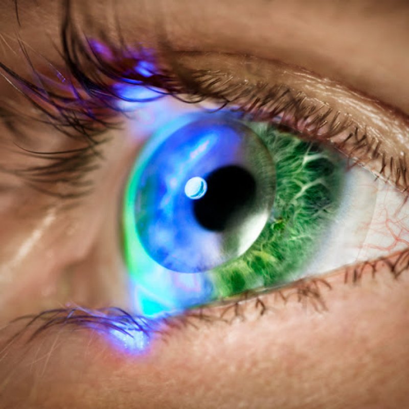 Мультифокальні контактні лінзи