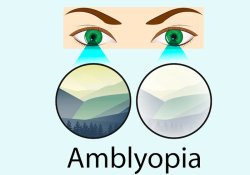 Коли очі лінуються