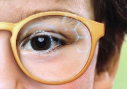 Лікування дитячої міопії